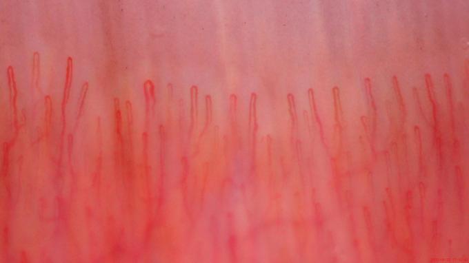 latest company news about Using Toproview's products as capillaroscopy - TOPROVIEW'S BLOG  0