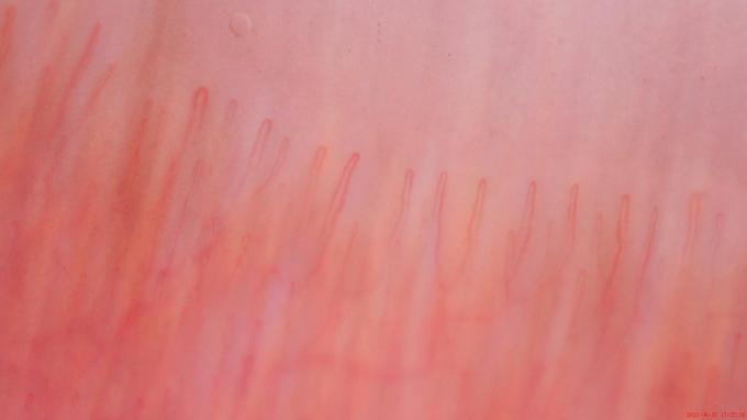 Hair Scalp Detector Digital Dermatoscope Polarized Skin Microscope 200x Work 0