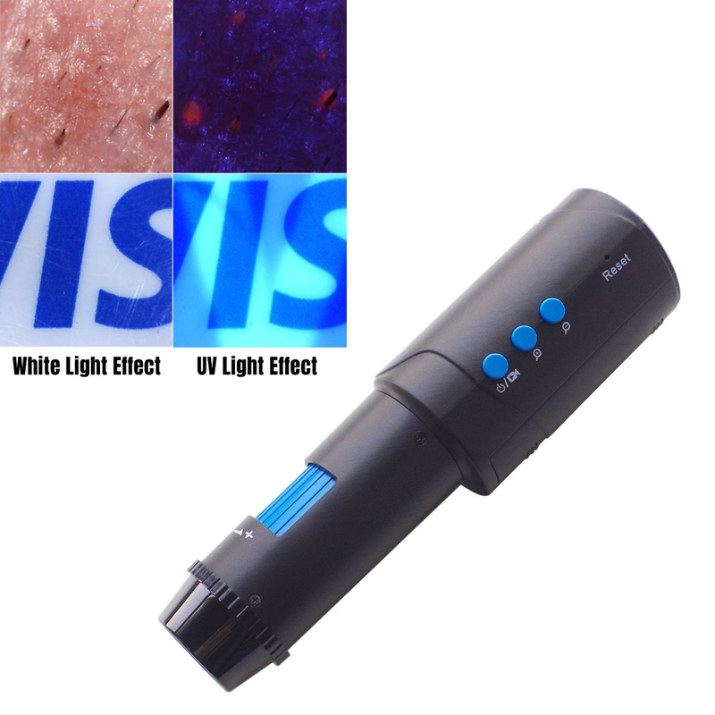 HD 1080P Digital Dermatoscopy With UV Light For Mole Inspection